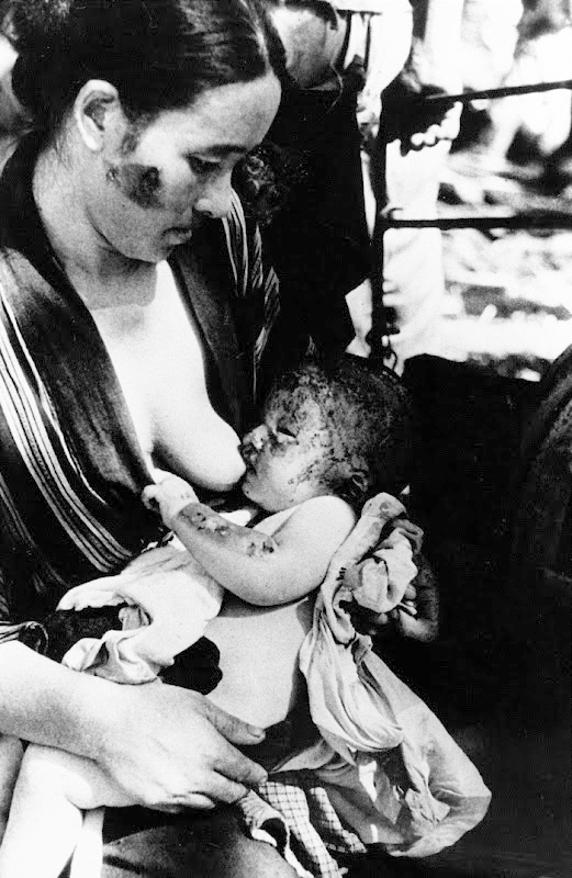 Madre e hijo luchando por seguir adelante, un día después de la caída de la bomba en Nagasaki. 10 de agosto de 1945. Foto: AP